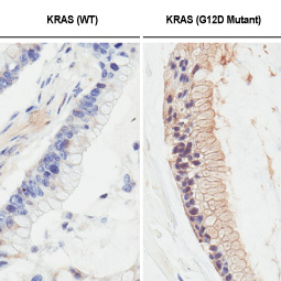 RAS (G12D Mutant) antibody [HL10] (GTX635362)